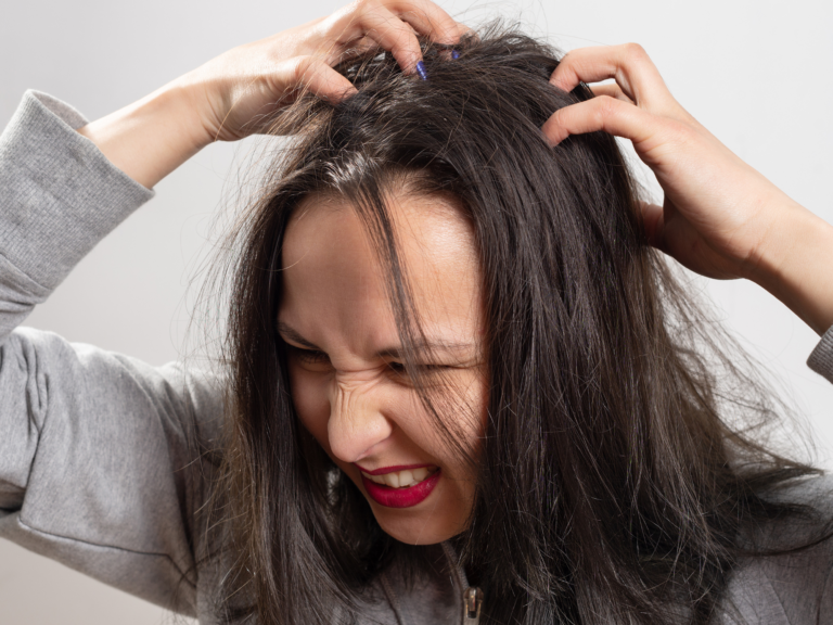 6 BEST HOMEMADE REMEDIES FOR ITCHY SCALP
